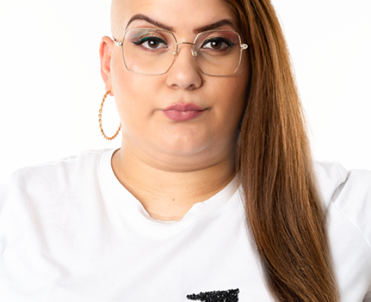 Kreisrunder Haarausfall (Alopecia Areata) Daniela mit und ohne Perücke